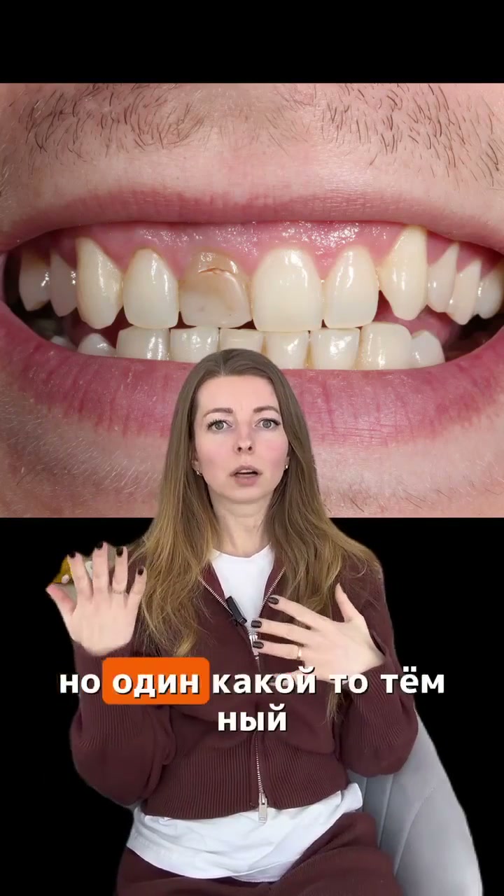 Почему зубы темнеют?