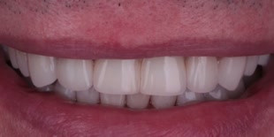 Пациент клиники после лечения.