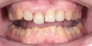 Пациент клиники до лечения.