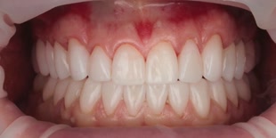 Пациент клиники после лечения.