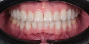 Пациент клиники после лечения.