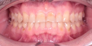 Пациент клиники до лечения.